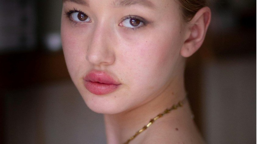 What If I Had Lip Fillers Before I Found Out I Was Pregnant?
