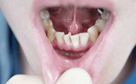 The Importance of Accurate Diagnosis