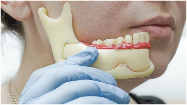 Calcium and Phosphorus for Bone Health